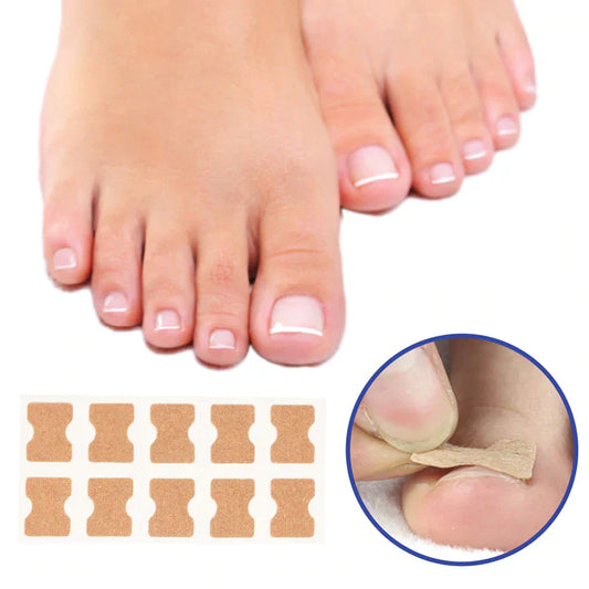 Corrigerende patches voor gezonde en mooie nagels 